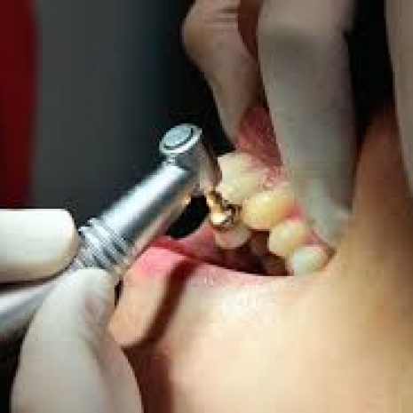  Dentisti low cost Verona.