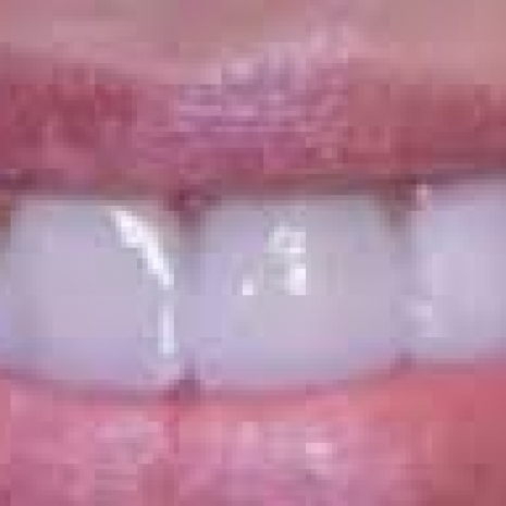 Pulizia dei denti.