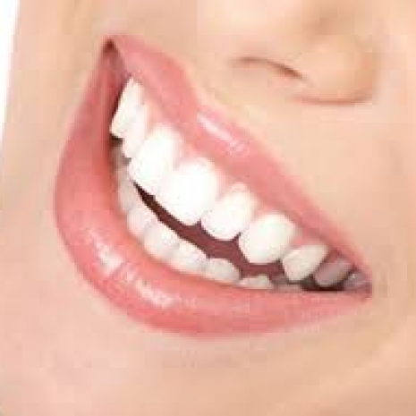 Pulizia denti Verona.