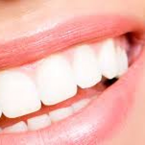 Pulizia denti Parma.