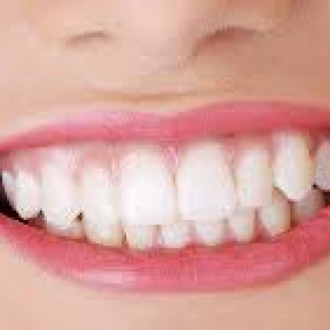 Impianti dentali Neodent 450 euro.